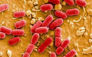 Escherichia coli (эшерихия коли) в моче