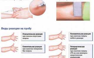 Температура 37 5 урология