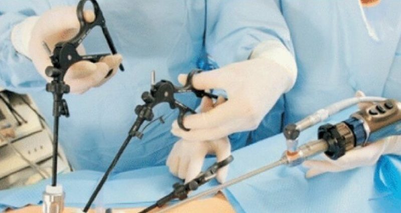 laparoskopicheskiy_metod_operacii_na_prostate_1_09163859